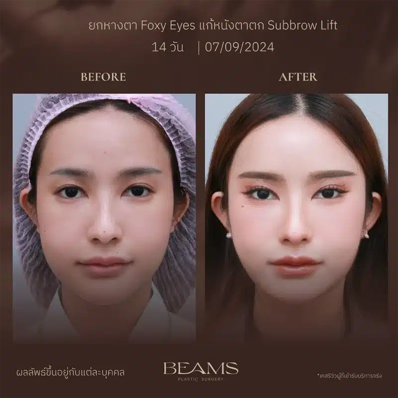 ปัญหาที่ Foxy Eyes แก้ได้
