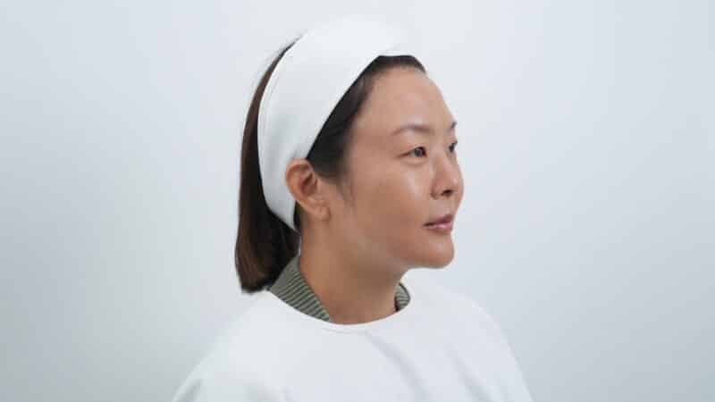 Before & after คุณลุลา