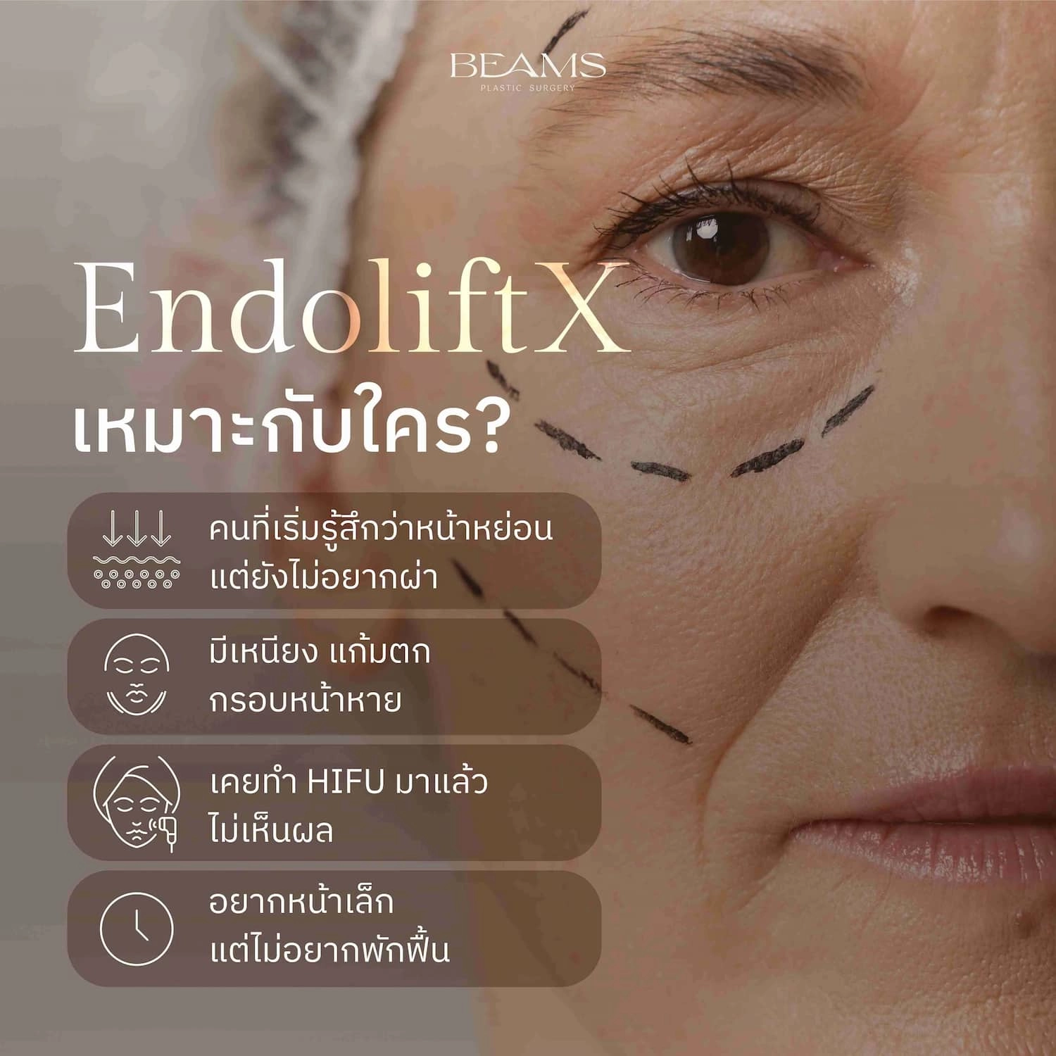 Endolift X เหมาะกับใคร