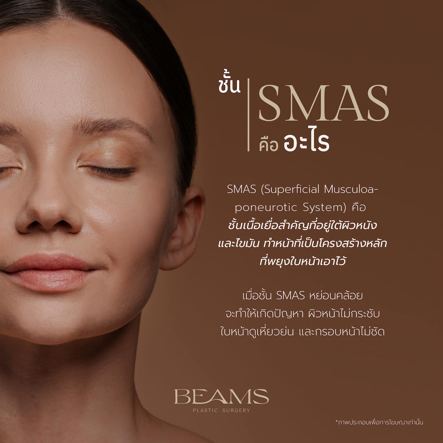 Smas คืออะไร