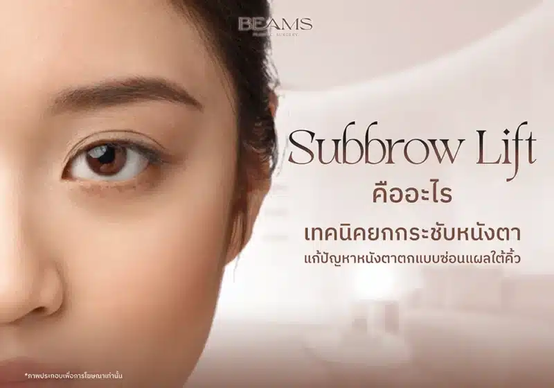 Subbrow lift ยกกระชับหนังตา
