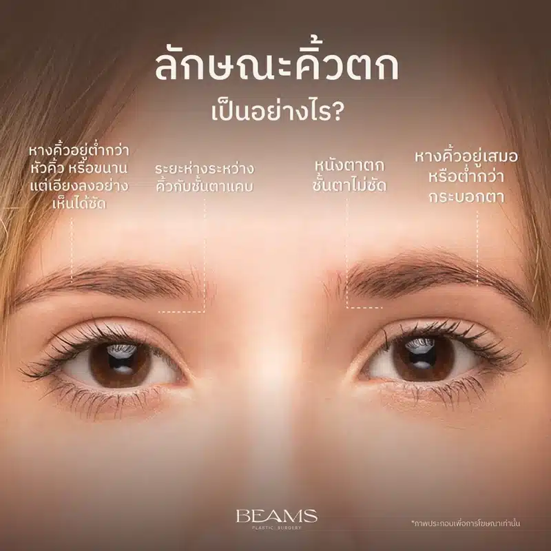 ลักษณะคิ้วตก