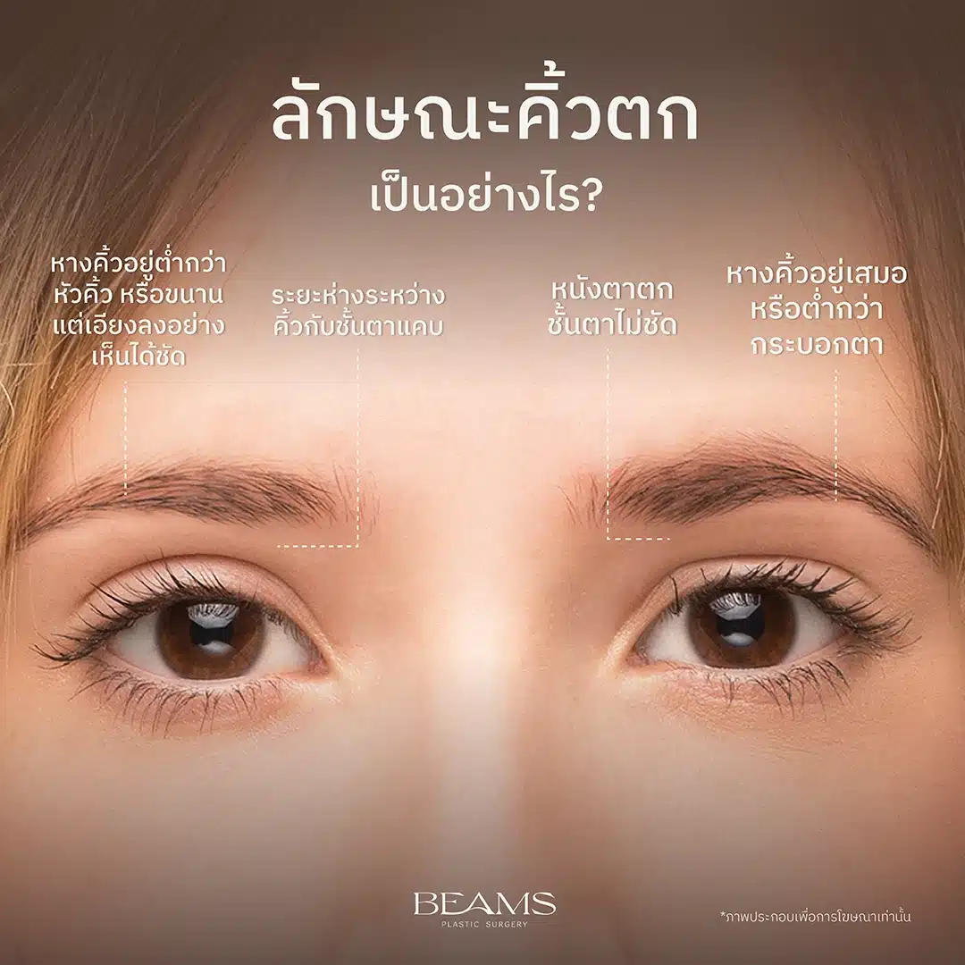 ลักษณะของคิ้วตก