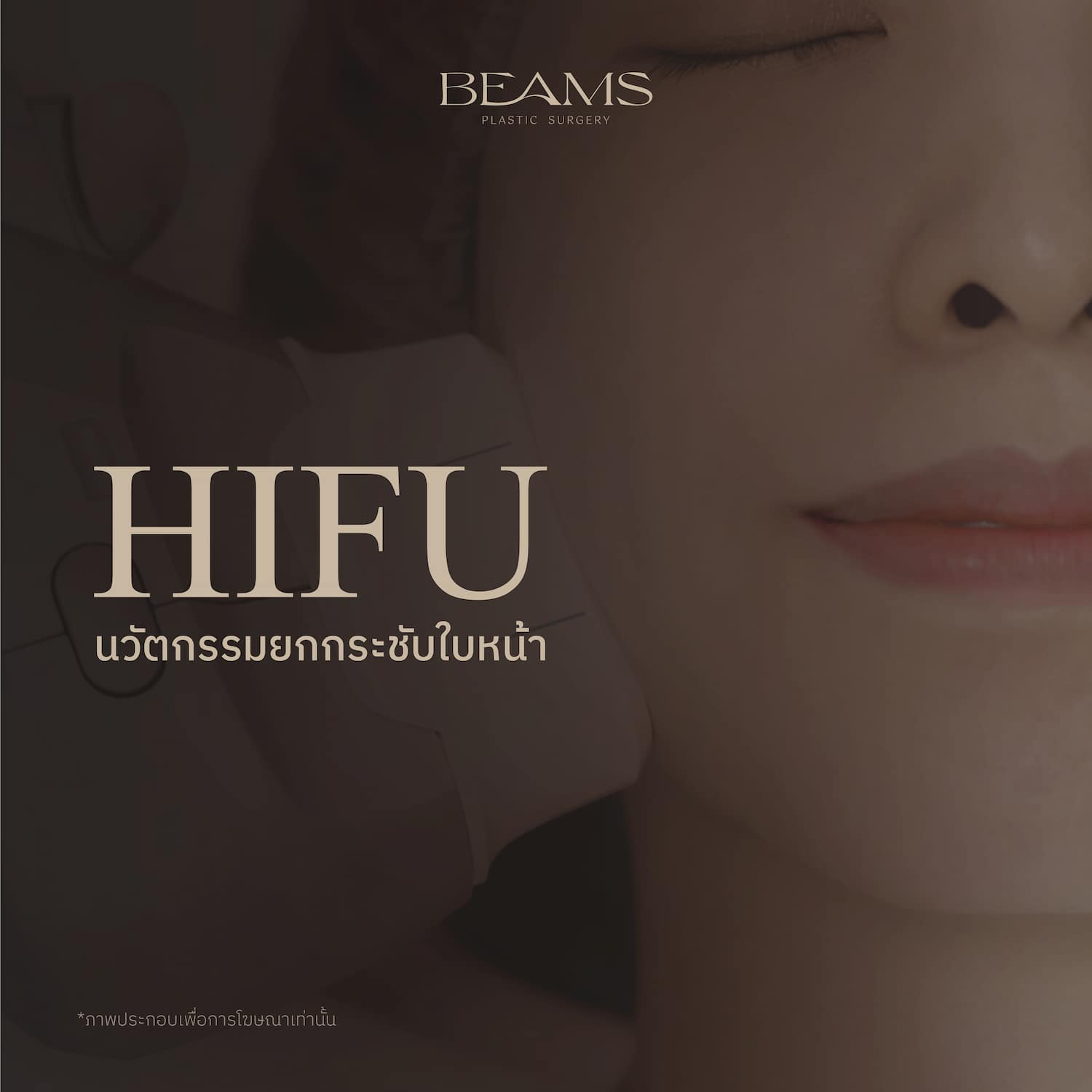 ยกกระชับ ด้วย HIFU