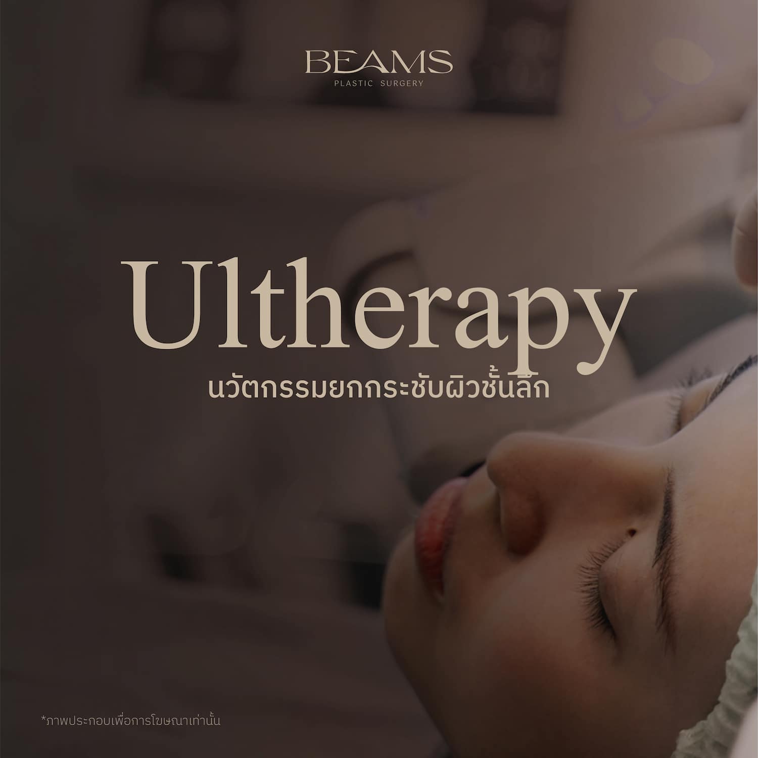 เครื่อง Ultherapy