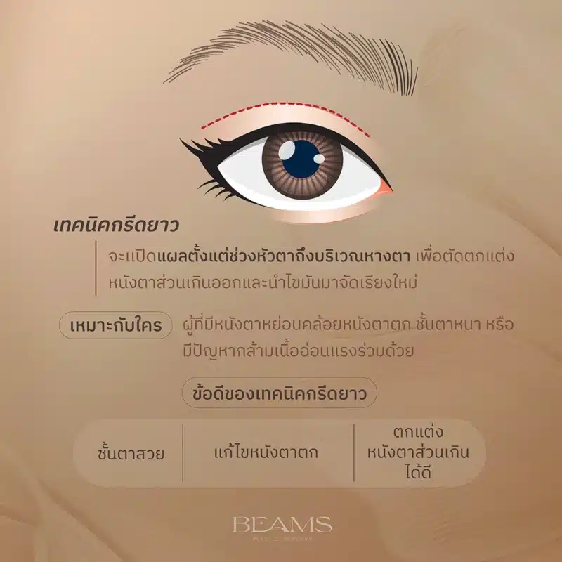 เทคนิคกรีดยาว