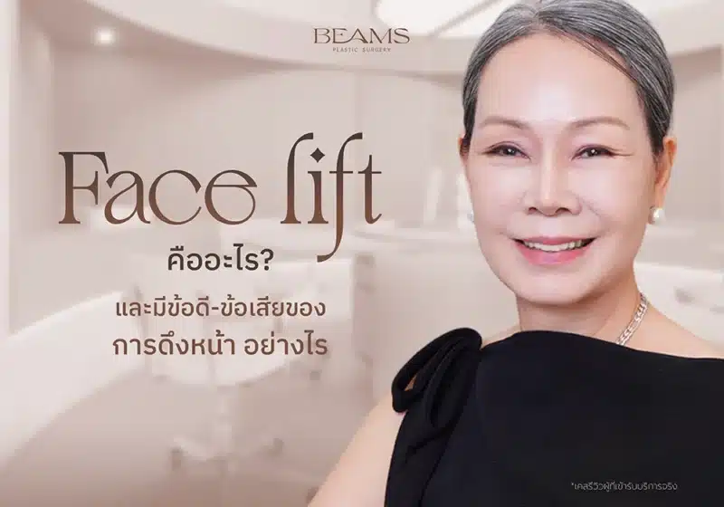 ดึงหน้า (Face lift) คืออะไร