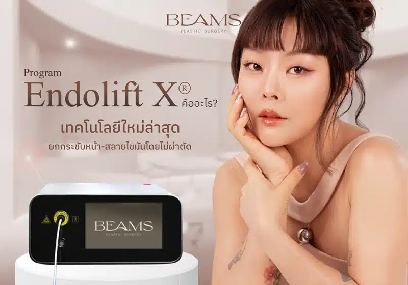 EndoliftX ยกกระชับหน้า-สลายไขมันโดยไม่ผ่าตัด