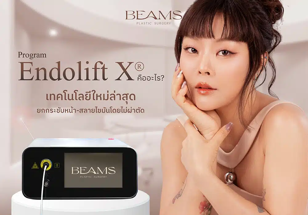 EndoliftX ยกกระชับหน้า-สลายไขมันโดยไม่ผ่าตัด