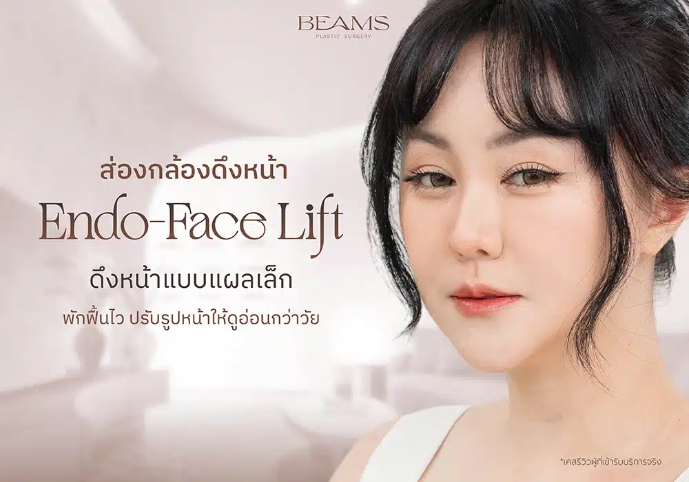 ศัลยกรรมส่องกล้องดึงหน้าคืออะไร