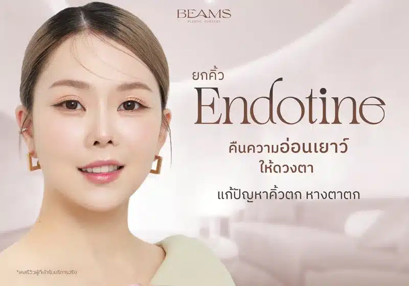 ยกคิ้ว Endotine (เอนโดไทน์) คือ
