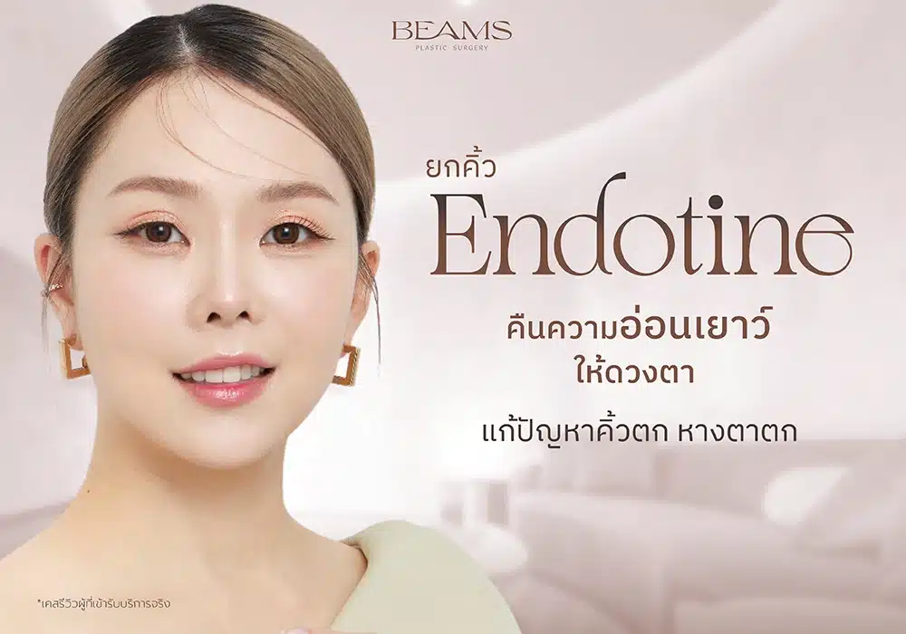 ยกคิ้ว Endotine (เอนโดไทน์) คือ