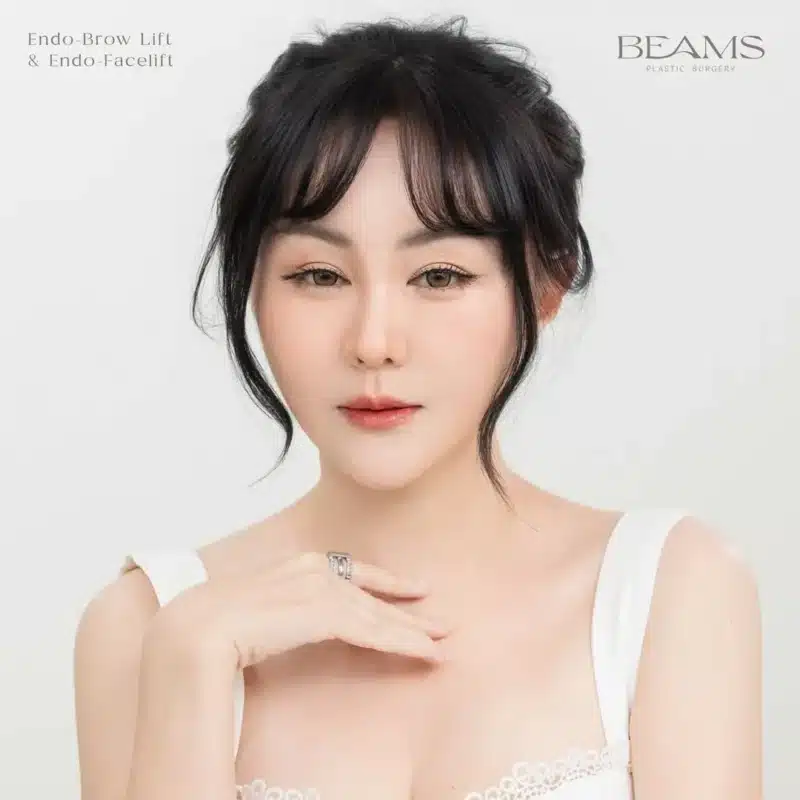 ส่องกล้องดึงหน้า_คุณอาเล็ค