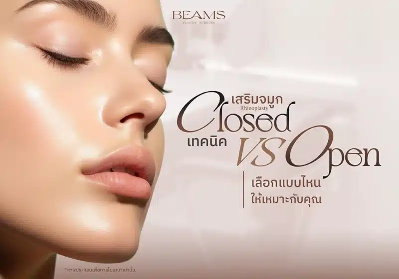 เสริมจมูกเทคนิคและวิธีเลือกที่เหมาะกับคุณ