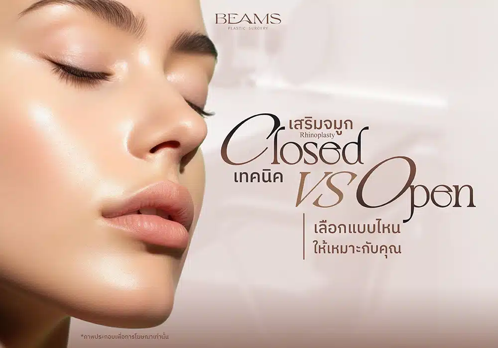 เสริมจมูกเทคนิคและวิธีเลือกที่เหมาะกับคุณ