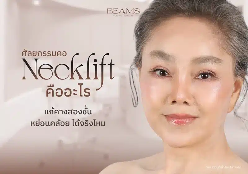 Necklift ศัลยกรรมคอ