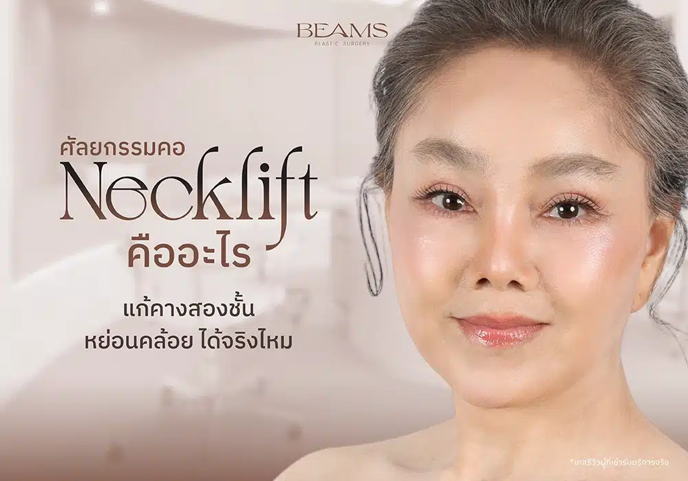 Necklift ศัลยกรรมคอ