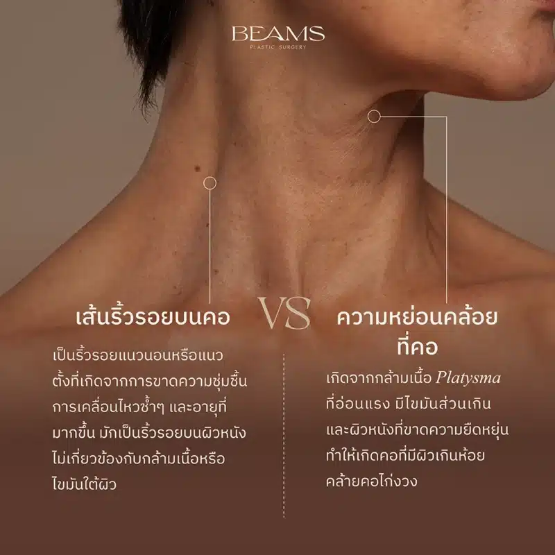 ริ้วรอยของคอ VS ความหย่อนคล้อยของคอ