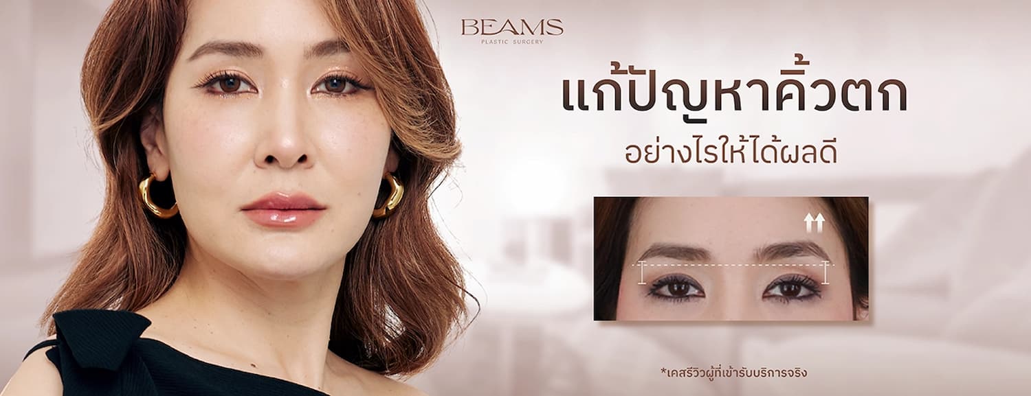 คิ้วตก คืออะไร