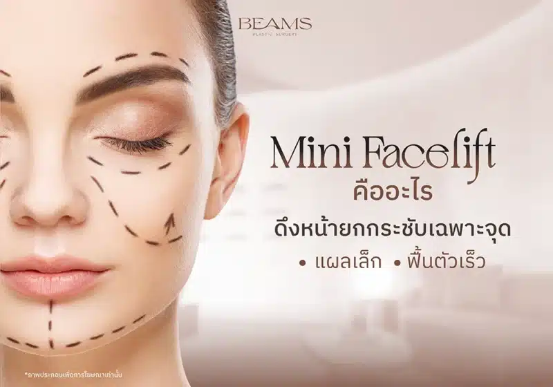 ดึงหน้า Mini face lift