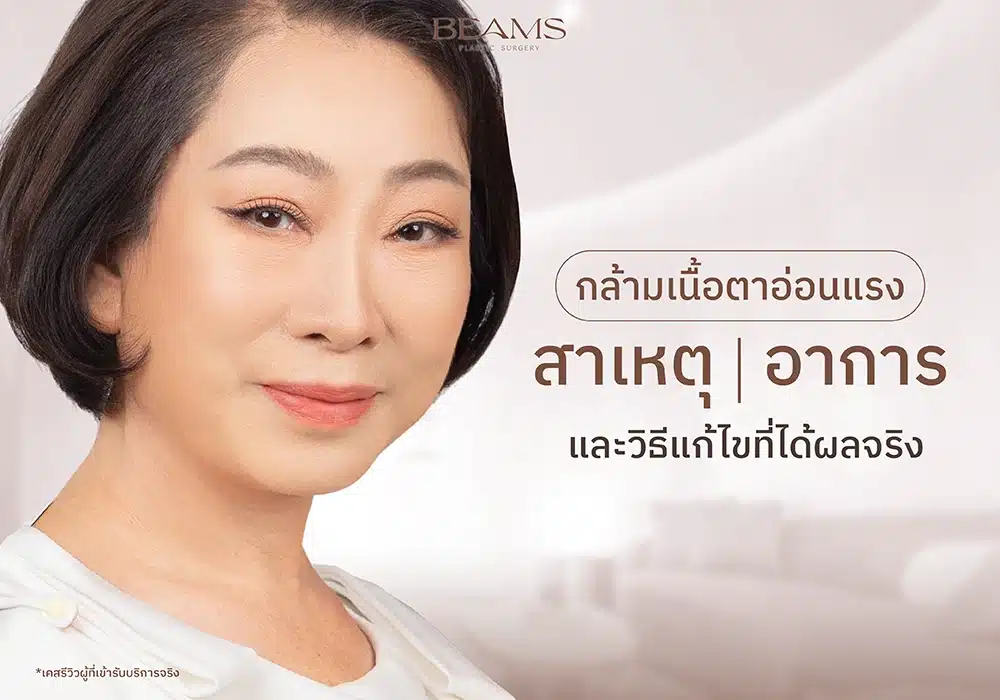 กล้ามเนื้อตาอ่อนแรง คือ