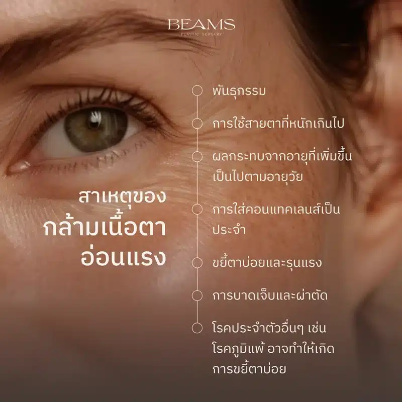 สาเหตุการเกิดกล้ามเนื้อตาอ่อนแรง