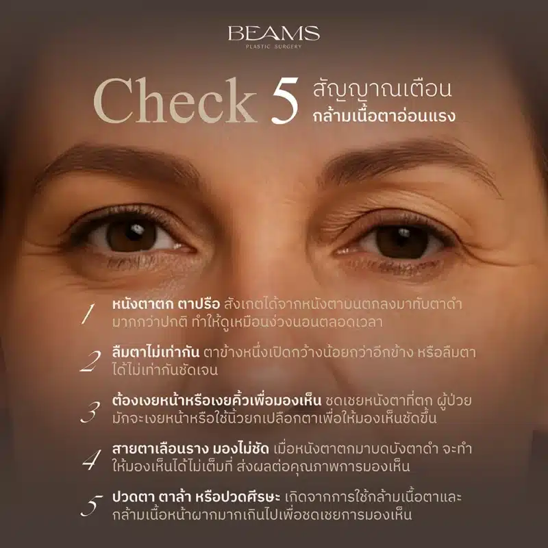 เช็ก! สัญญาณเตือนกล้ามเนื้อตาอ่อนแรง