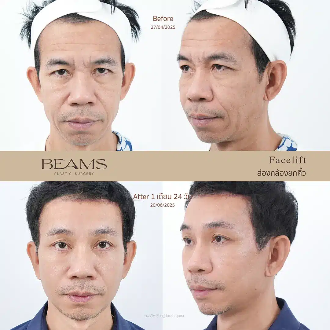 รีวิวคุณหนุ่ย