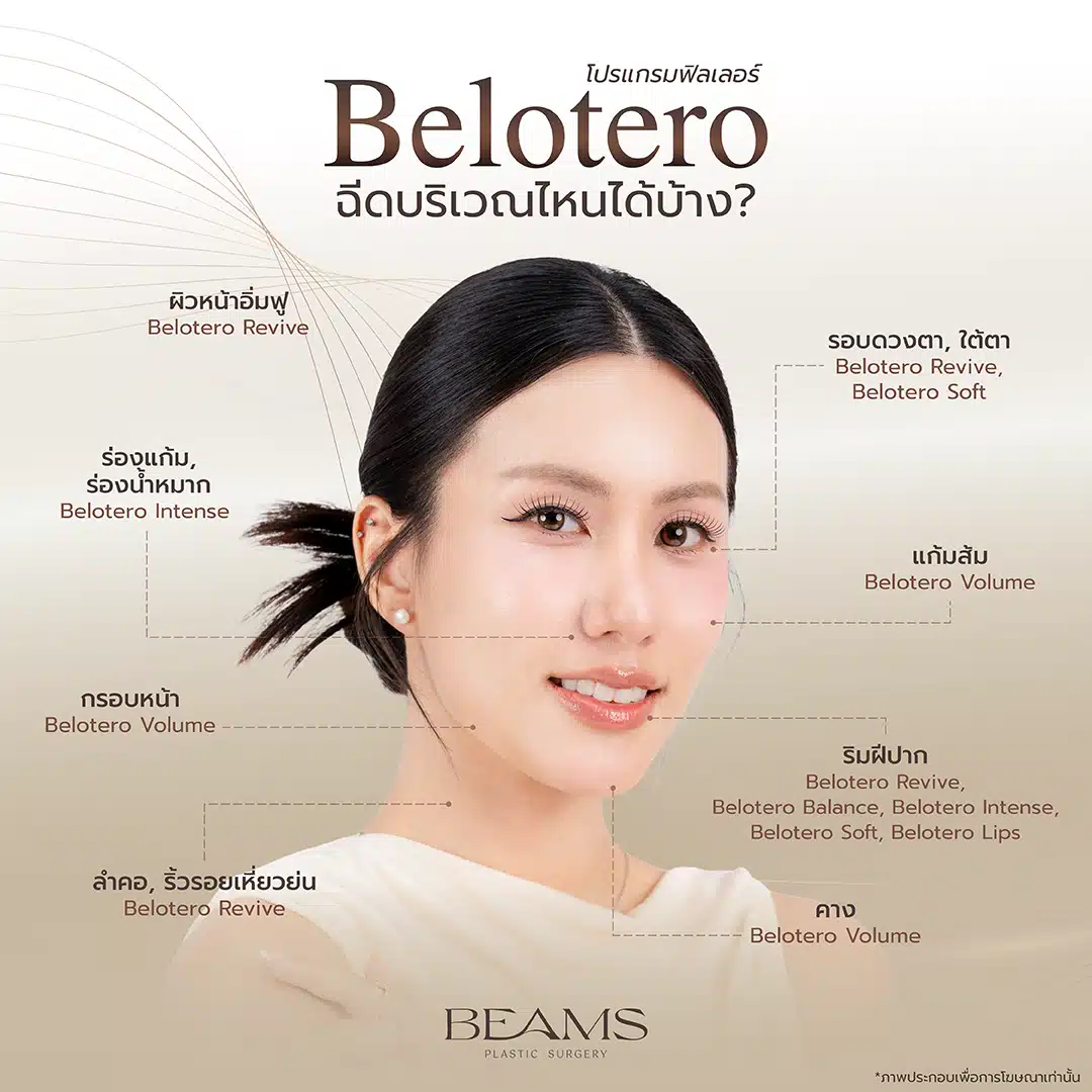 ฟิลเลอร์ Belotero ฉีดตำแหน่งไหนบ้าง