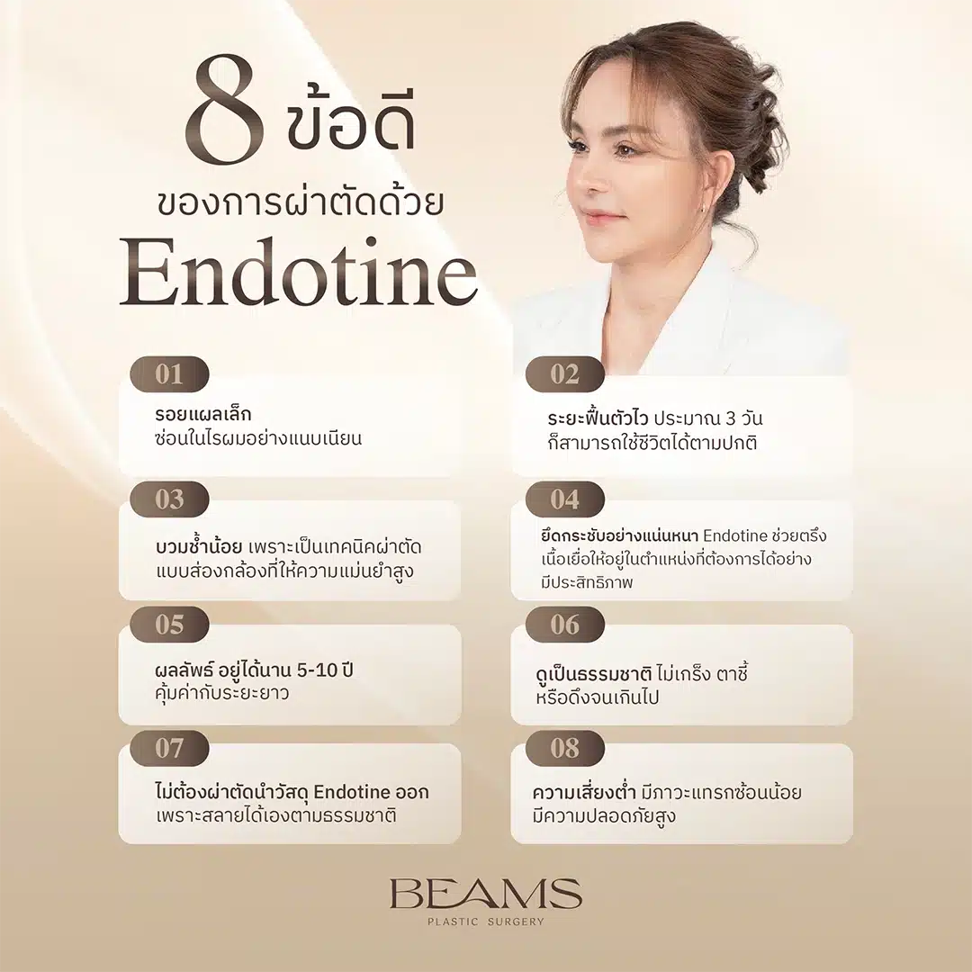 ข้อดี-ข้อจำกัด ผ่าตัด Endotine