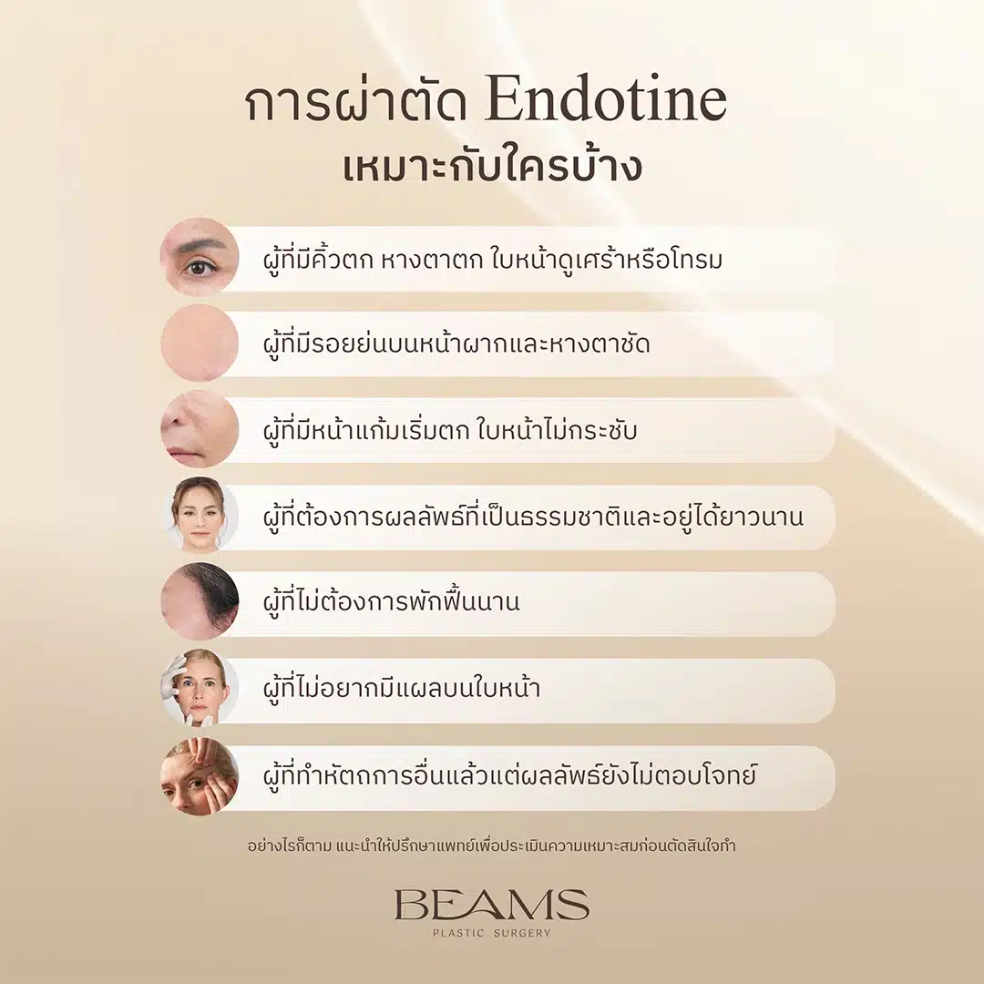 ผ่าตัด Endotine เหมาะกับใคร