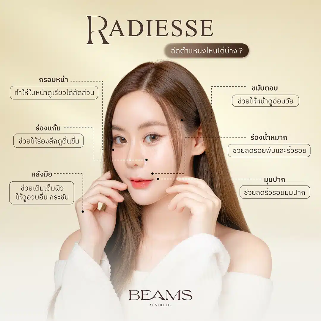 การฉีด Radiesse เหมาะกับใคร