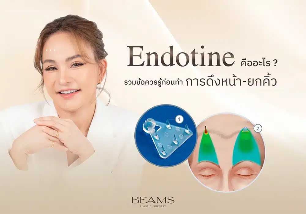 Endotine คืออะไร