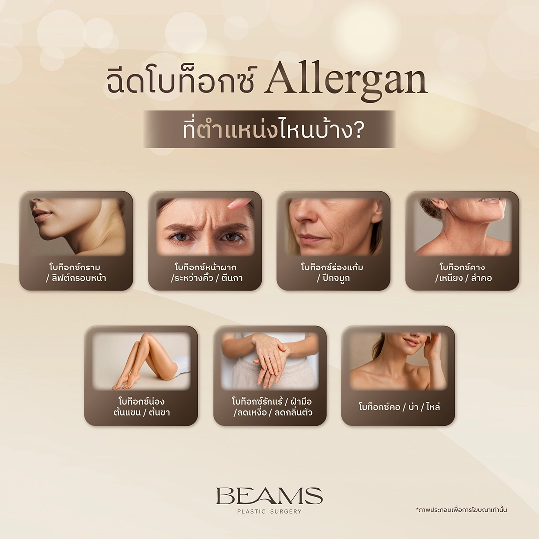 โบท็อกซ์ Allergan ฉีดตรงไหนได้บ้าง