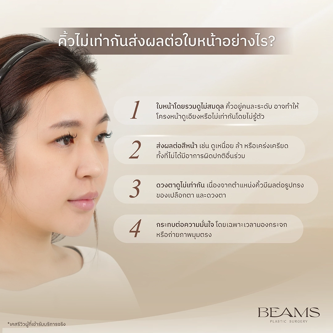 คิ้วไม่เท่ากันบนใบหน้า