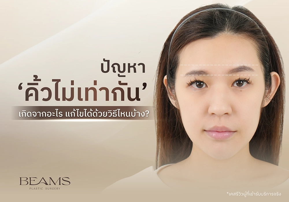 คิ้วไม่เท่ากัน