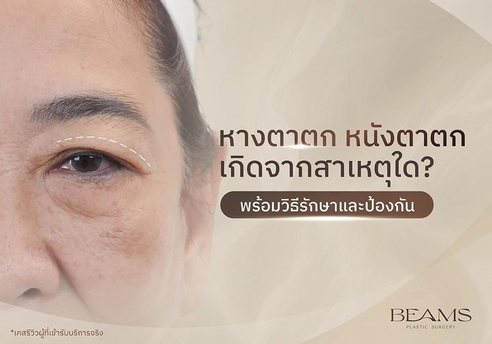 หางตาตก หนังตาตก เกิดจากสาเหตุใด