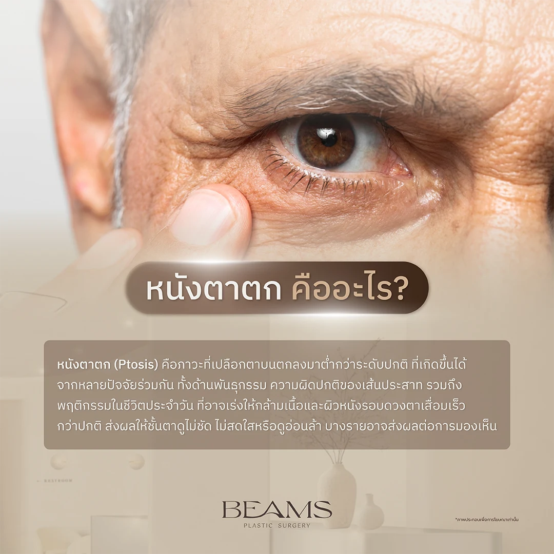 หนังตาตกคืออะไร