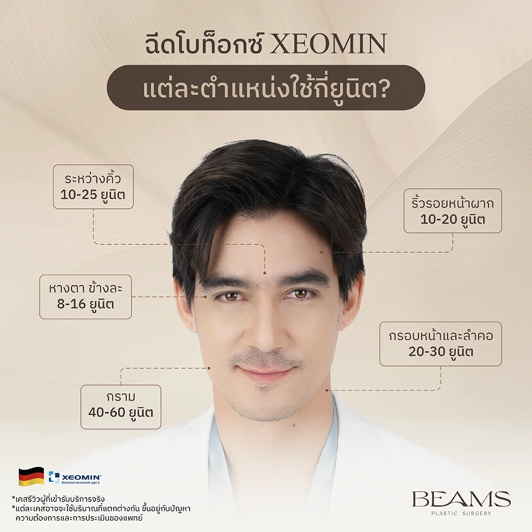 โบท็อซ์ Xeomin ฉีดตรงไหน