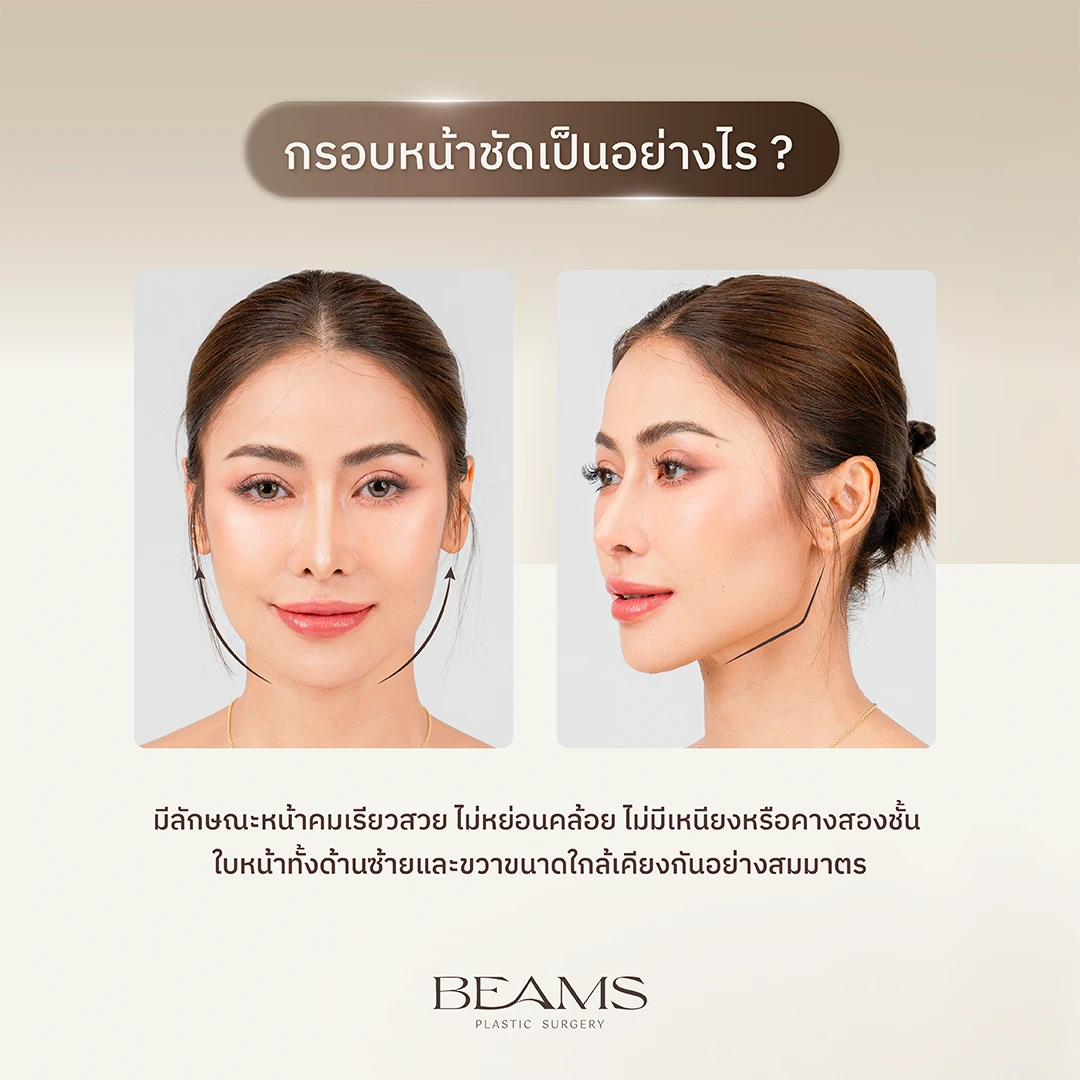 ลักษณะกรอบหน้าชัด