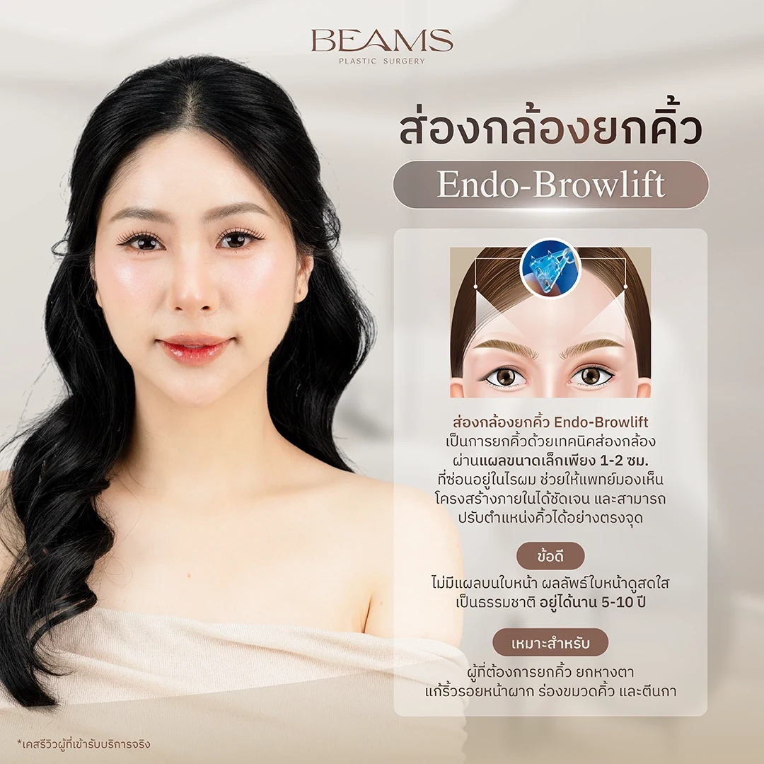 ส่องกล้องยกคิ้ว