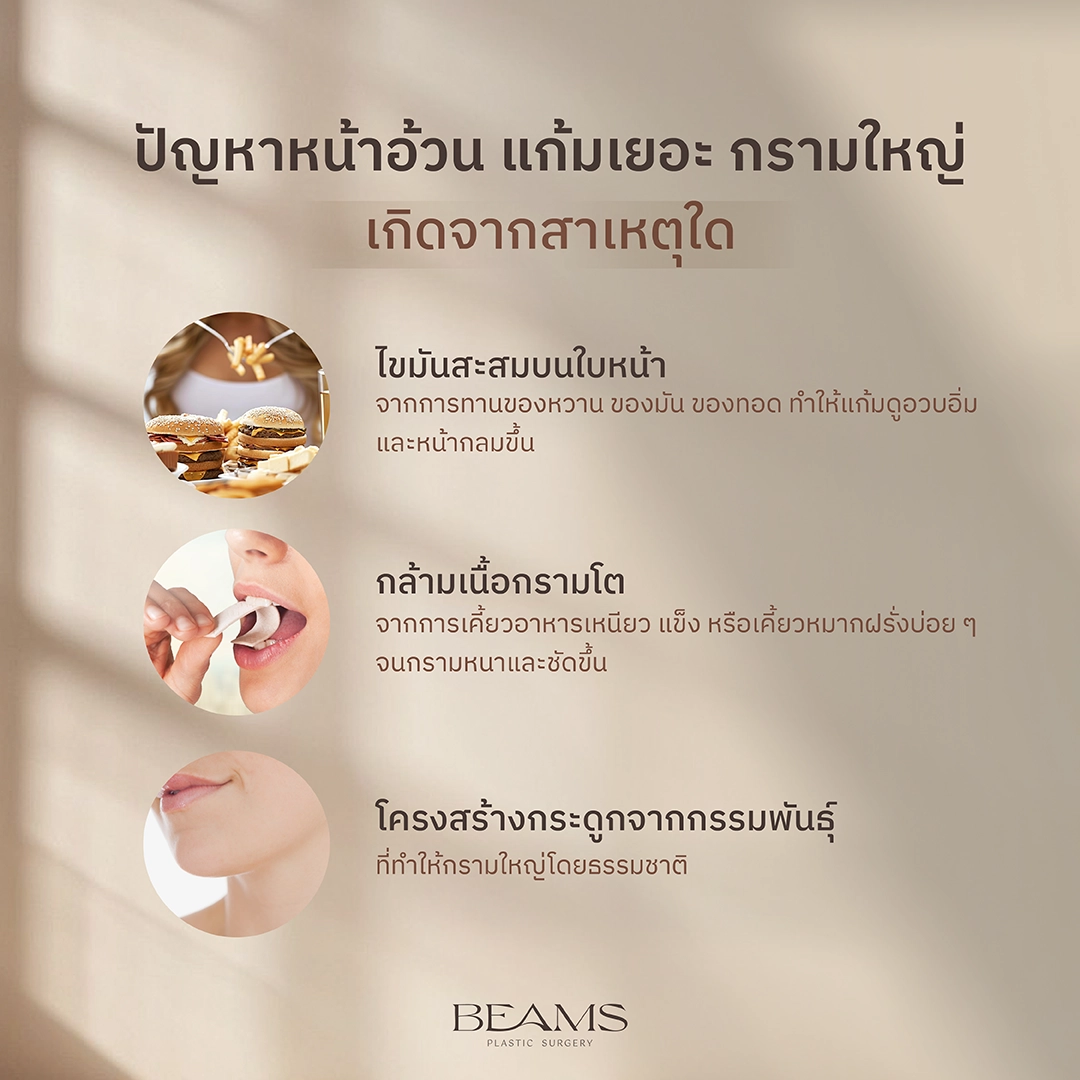 แก้มเยอะ เกิดจากอะไร