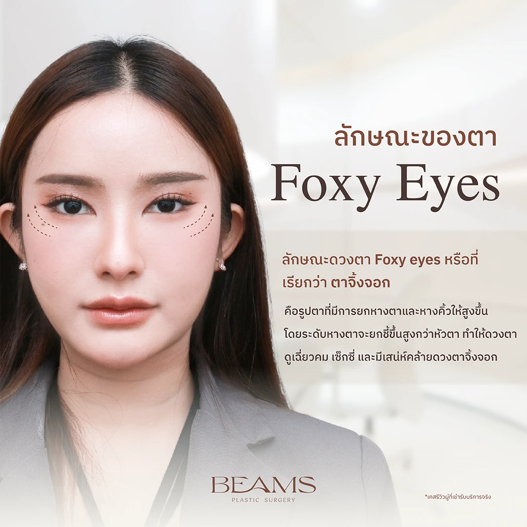 ลักษณะของตา Foxy Eyes