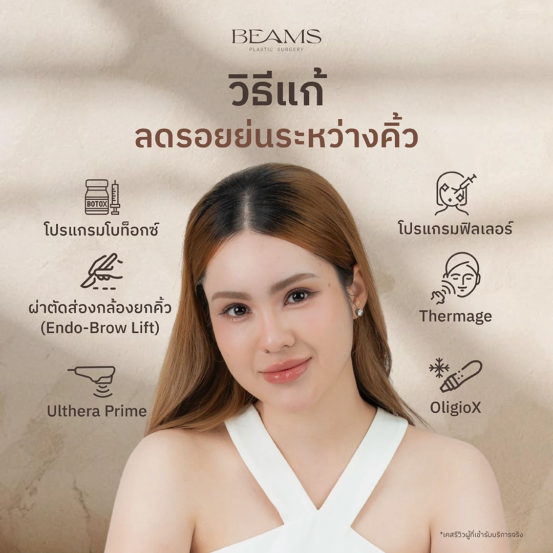 วิธีแก้รอยย่นระหว่างคิ้ว