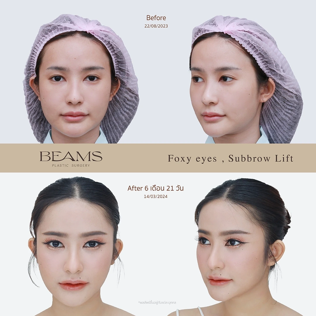 review-foxy-eyes-sb-k-nut