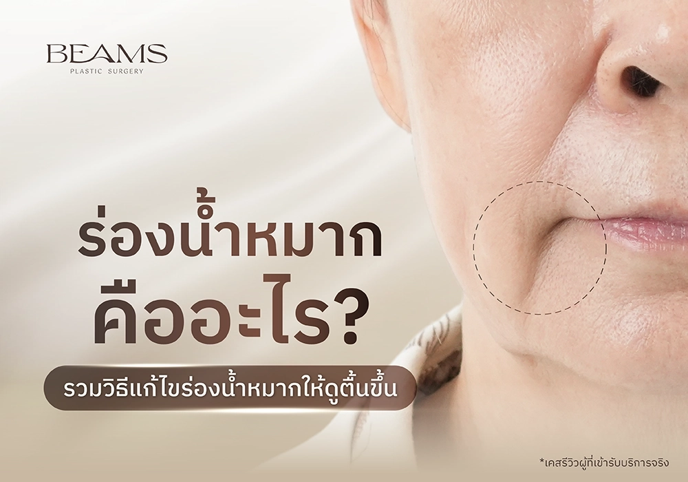 ร่องน้ำหมาก