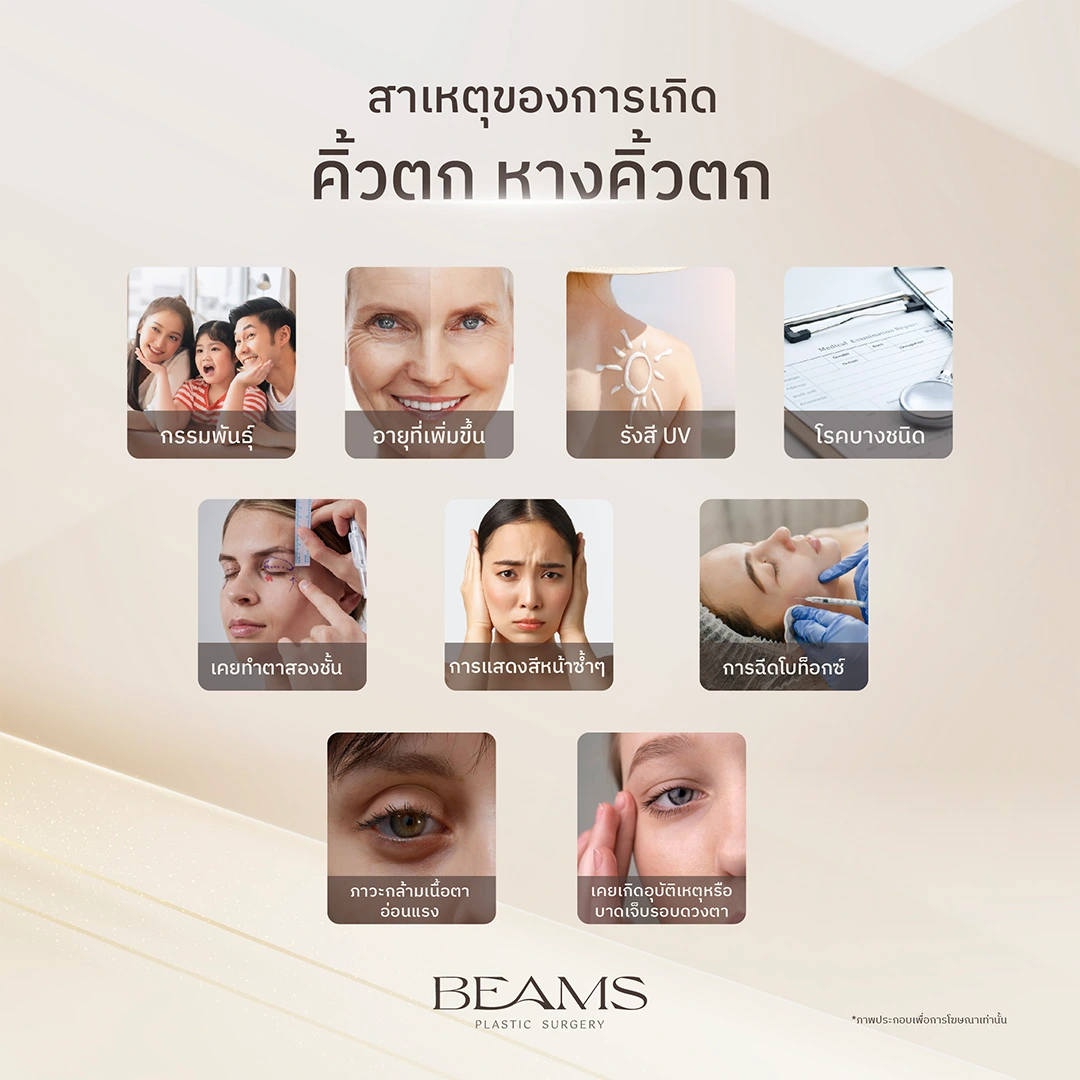 คิ้วตกเกิดจากสาเหตุอะไร