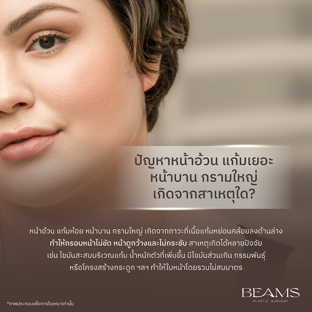 แก้มห้อย แก้มย้อย เกิดจากอะไร