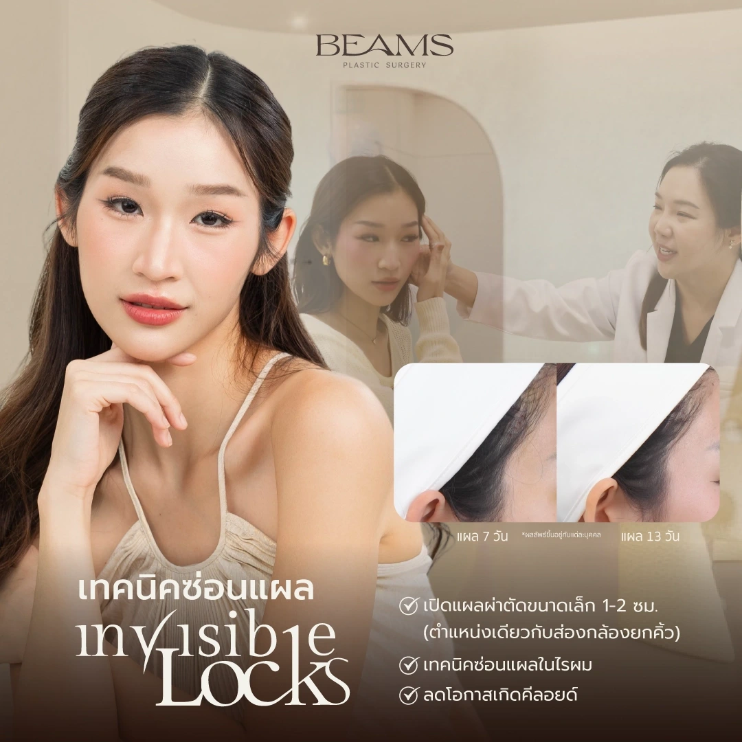 เทคนิค invisible locks