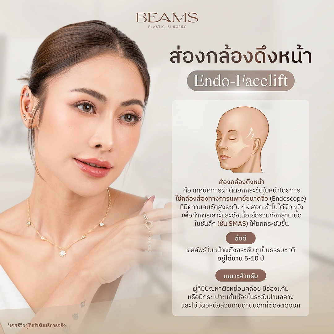 ส่องกล้องดึงหน้า